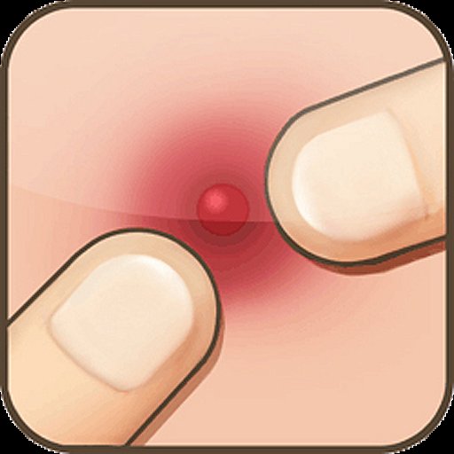 Pimple Popper - APK Download, MOD, Hack Tool, Cheats